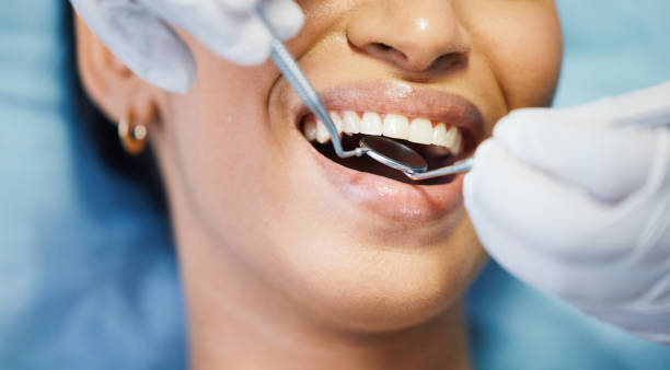 Best Broken or Chipped Tooth Repair in Lowell, MA